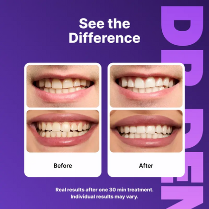 Purple Teeth Whitening Strips - 7/21 Whitening Sessions - Safe for Enamel - Non Sensitive Teeth Whitening - Peroxide-Free